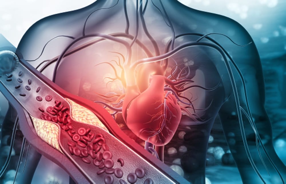 علماء يكشفون عن سر جديد وراء تشكّل الجلطات الدموية: التفاصيل الكاملة